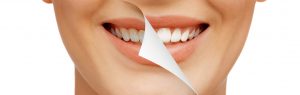 How To Maintain Your Teeth White